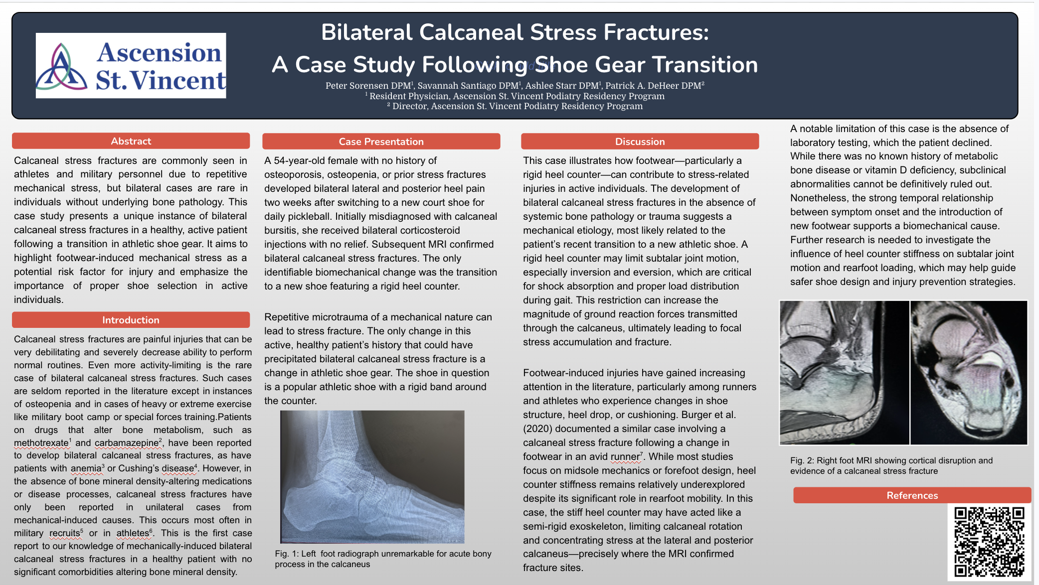 Poster for bilateral calcaneal stress fractures case study